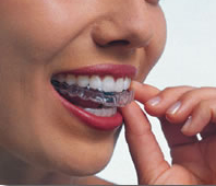 ホワイトニングトレー